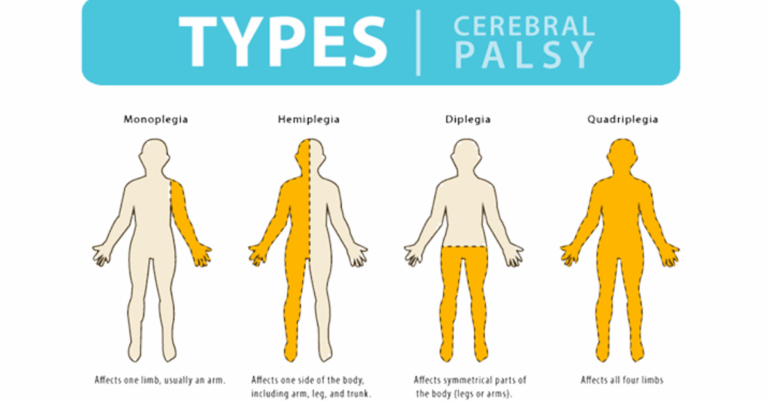 Unlocking Potential: Cerebral Palsy Stem Cell Therapy India – A Breakthrough in Treatment